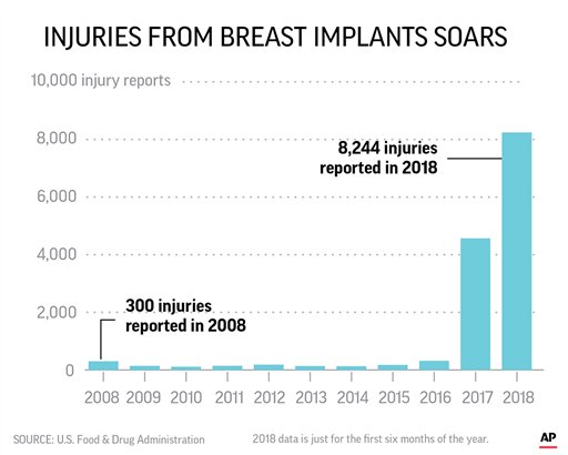 A change in FDA reporting policies in 2017 meant that reports of injuries from silicone gel-filled and saline-filled breast implants skyrocketed in the past year. Injury reports used to be provided in a quarterly tally, with one report standing in for thousands of individual cases.